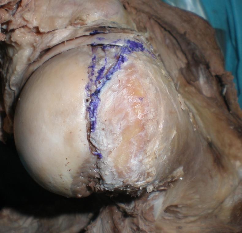 Biyomekanik olarak subskapularisin ürettiği kuvveti diğer üç rotator manşet kası ancak üretir (subskapularis %53, supraspinatus %14, infraspinatus %22 ve teres minör %10) (şekil 13).