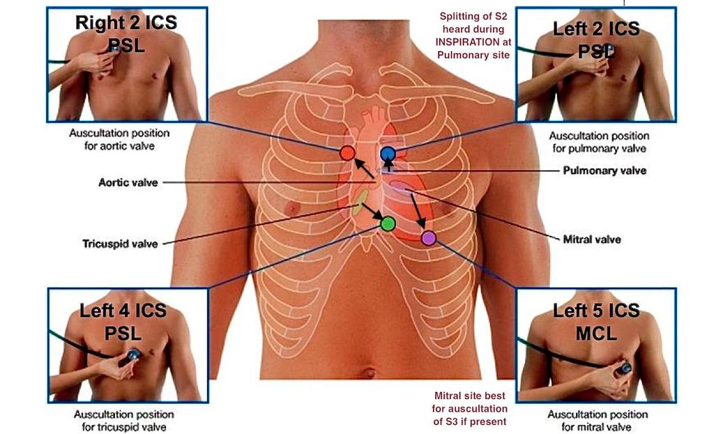 Valva bicuspidalis in (mitral) oskültasyonu