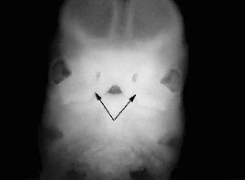 Şekil 1.1. Fetusta nares in inferior kenarlarının şekillenmesiyle fovea nasalis lerin belirginleşmesi (Kim ve ark 2004). Sıralı hücreler gelişerek CN de geçici epitel tabaka oluştururlar. 13. ve 15.