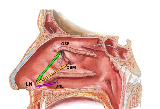 Limen nasi ve ostium sinus maxillaris arası mesafe (LN-OSM): Limen nasi ve ostium sinus maxillaris arası mesafe ölçümü (Şekil 2.10).