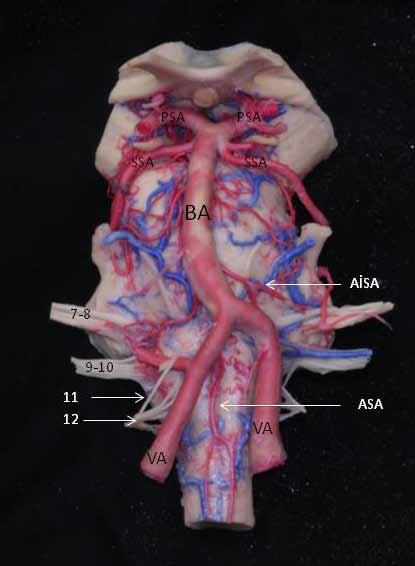 Dura içinde VA medullanın alt lateralinden üst medialine doğru yükselir. Arterin intradural kısmı anatomik olarak lateral ve anterior medüller segmentlere ayrılır.