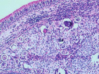 Medical Pathology nüks bildirilmiştir.