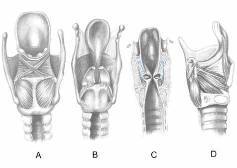 BÖLÜM 13a Subglottik Darlıklarda Cerrahi Tedavi 217 Şekil 1: A-B) Larinksin posterior anatomik görünümü ve larinks kaslarının aritenoid, krikoid ve tiroid kıkırdaklarla ilişkisi.