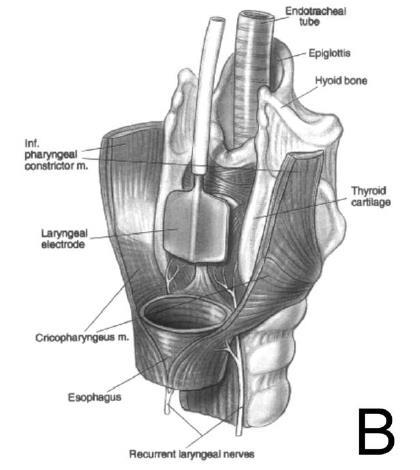 W. Laryngoscope 2017 Jan