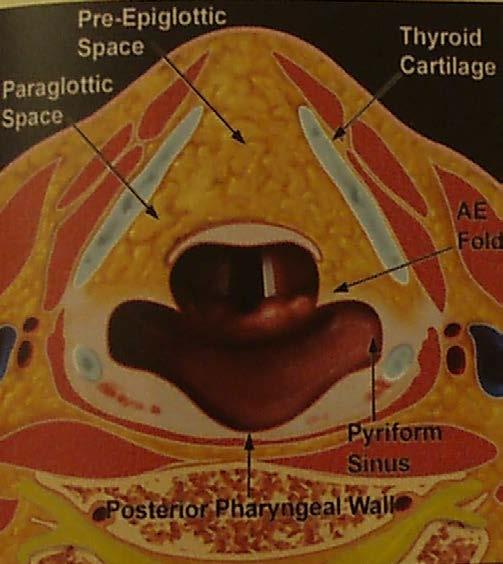 Broyle ligamanı