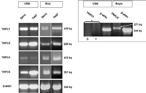 A) B) C) D) 50 45 Düz kas 200 Endotel Genç Yasli 40 175 TRPCx / B-aktin 35 30 25 4 3 TRPCx / B-aktin 150 125 40 30 2 20 1 10 0 TRPC1 TRPC3 0 TRPC4 TRPC6 0 TRPC1 TRPC3 0 TRPC4 TRPC6 Şekil 3.