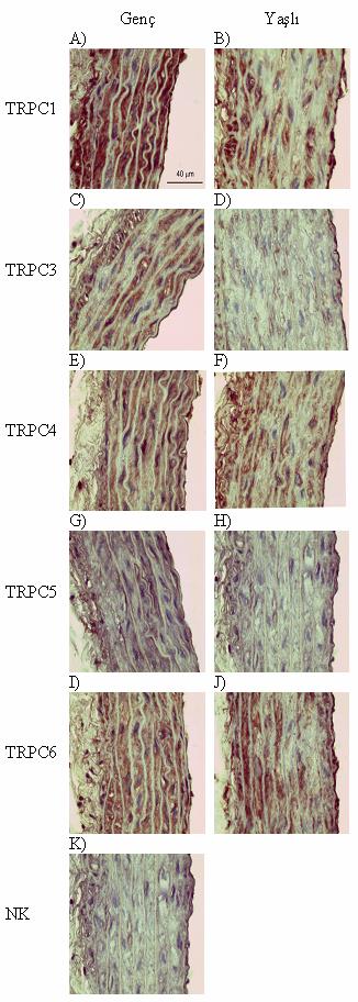 Şekil 3.7: TRPC proteinlerinin IHC yöntemi ile belirlenmesi TRPC antikorları ile TRPC proteinlerinin genç ve yaşlı sıçan torasik aort kesitlerinde belirlenmesi.