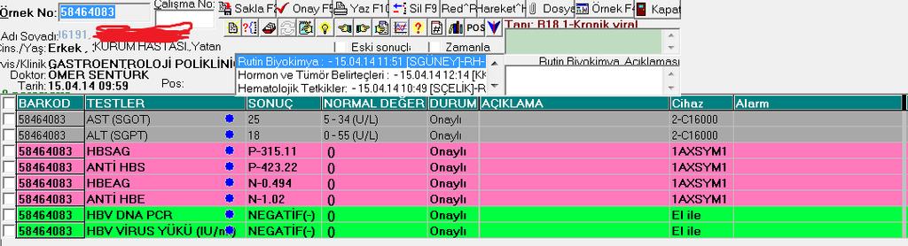 HBsAg ve antihbs bir arada pozitif saptanabilmektedir. Çoklu HBV enfeksiyonu mu?