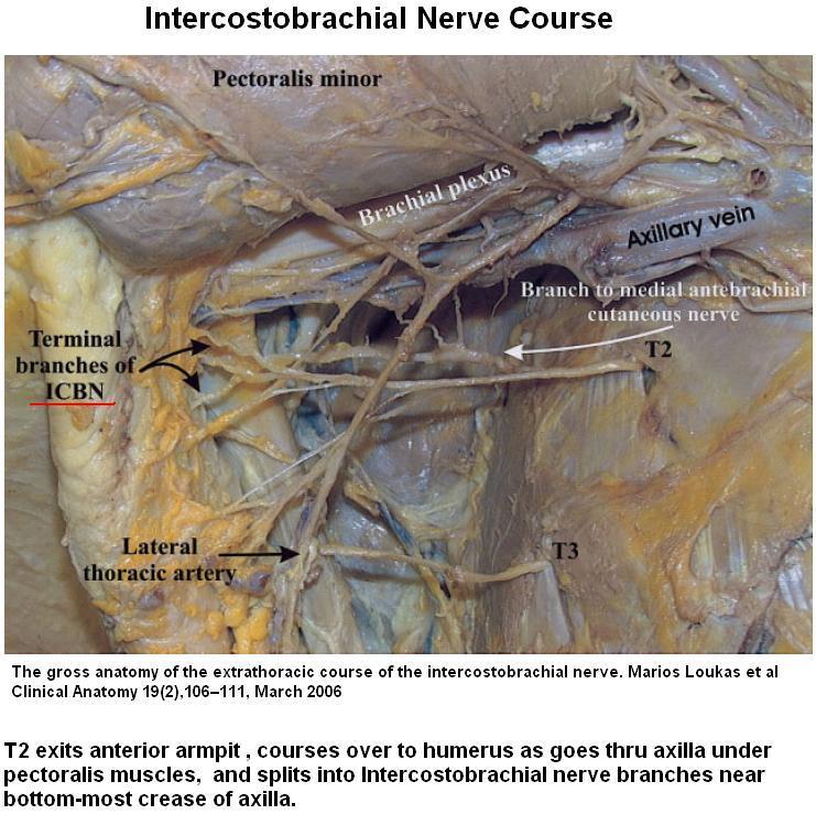 FOSSA AXILLARIS İN İÇİNDE BULUNAN ANATOMİK YAPILAR İnterkostal sinirlerin yan dalları N.