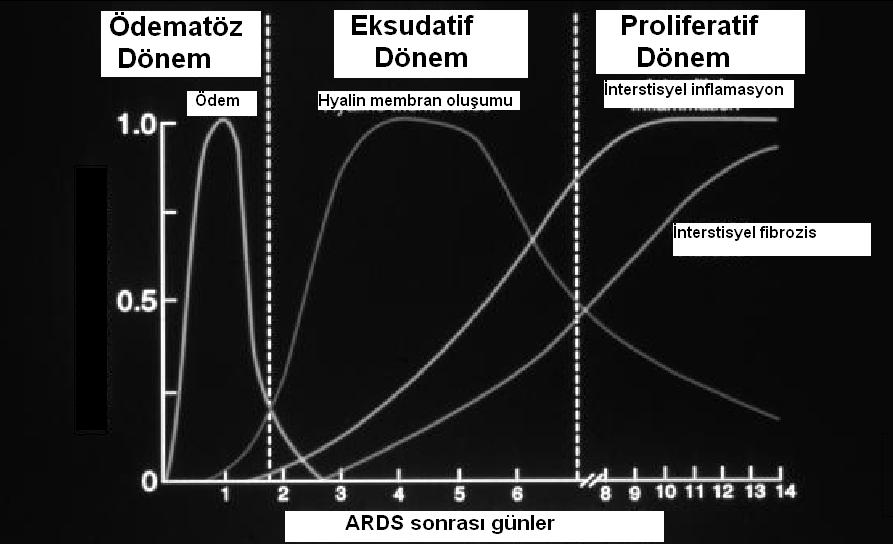 ALI de histolojik değişiklikler PPE deki