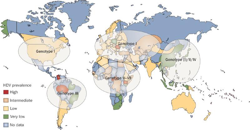 HDV genotip 1 HBV genotipi 3 Epidemiology, pathogenesis and management of hepatitis D: