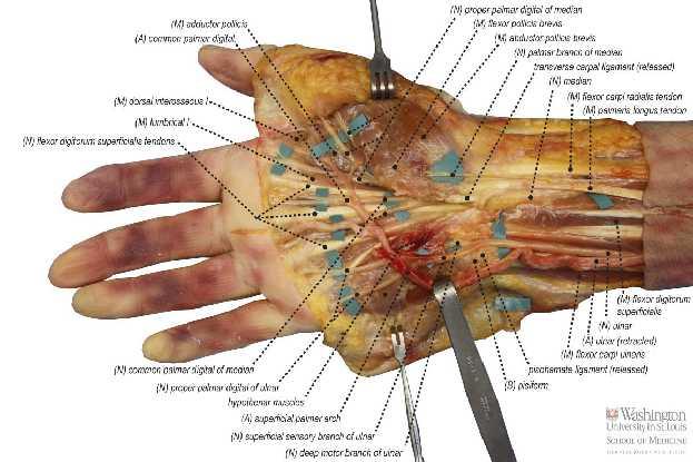 Fasciculus medialis ten çıkanlar N. ulnaris A.