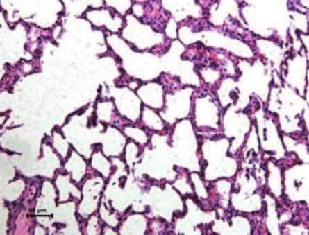 interstisiyel hücrelerin yoğunluğu ve arterlerin çevresinde perivasküler ödem. (Hematoksilen-eozin X200). (Renkli hali için Bkz. http://anestezi.turkiyeklinikleri.