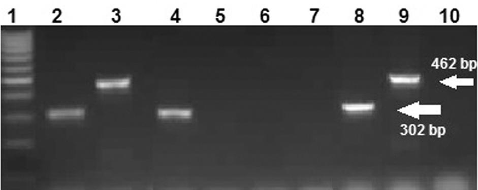 Escherichia coli ve Klebsiella pneumoniae Kan Kültürü zolatlar nda Plazmid Arac l AmpC Beta-Laktamaz Varl n n Araflt r lmas Şekil 2.