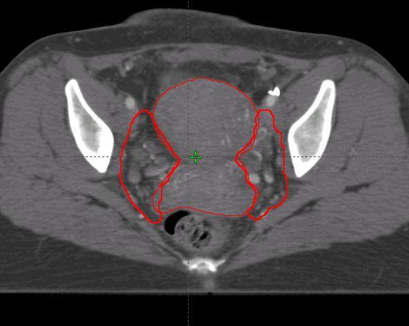 CT Case 1