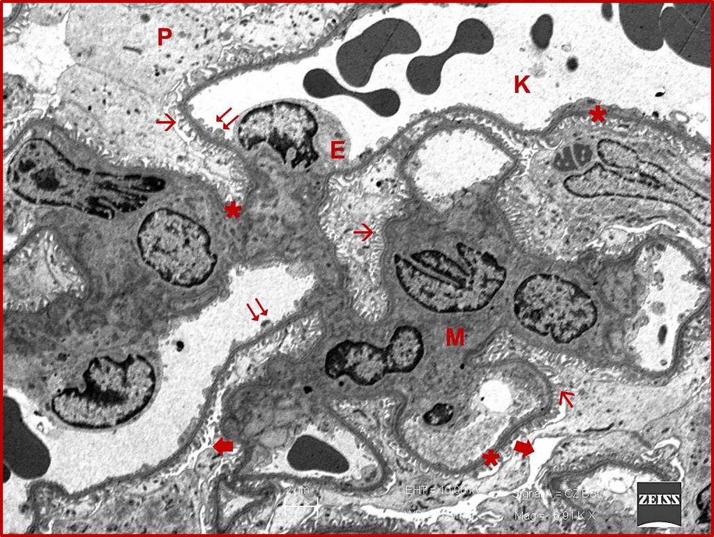 73 Resim 4.2. Kontrol grubuna ait büyük büyültmeli resimde normal ince yapıda izlenen böbrek glomerülü görülüyor.