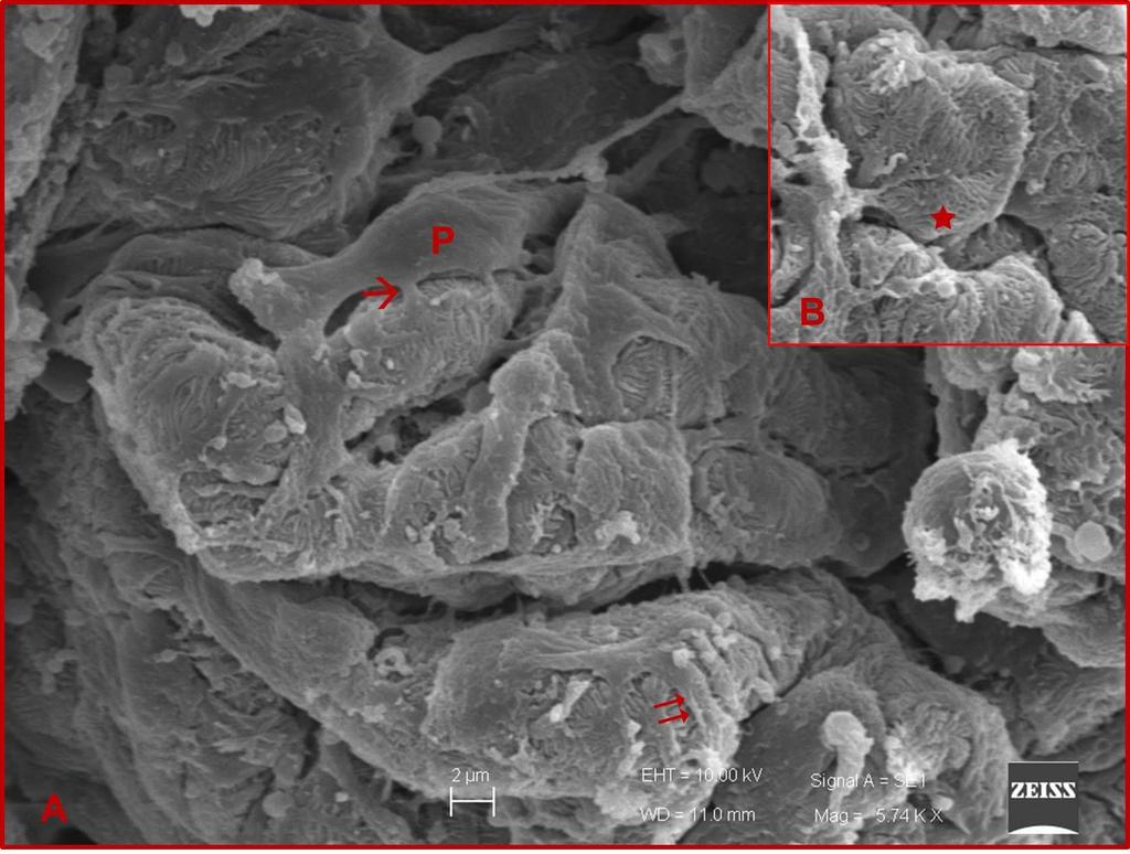 79 Resim 4.8. Mısır yağı uygulanan grupta taramalı elekton mikroskop ile yapılan değerlendirmede böbrek glomerülü görülüyor.