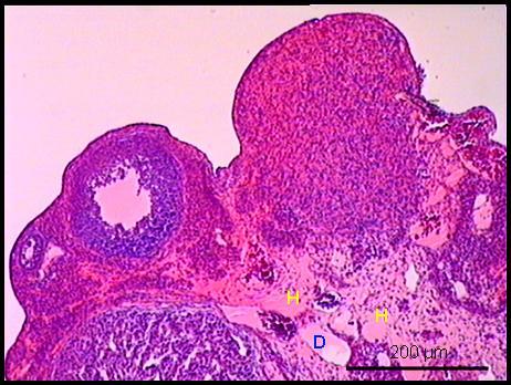 Resim 7: EMA grubuna ait ovaryum kesiti Bağ dokuda