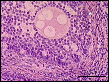 * * * D D 200 μm Resim 10: EMA+LA grubuna ait ovaryum kesiti EMA grubuna göre bağ doku