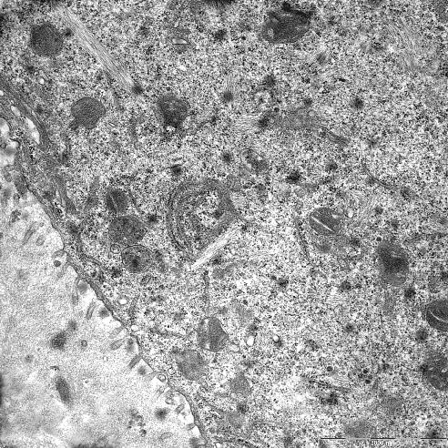 EMA+LA grubunda: Oosit sitoplazmasında çok sayıda mitokondri, pinositotik veziküller, caveolalar ve perivitellin aralıkta çok sayıda mikrovillus görülmüştür.