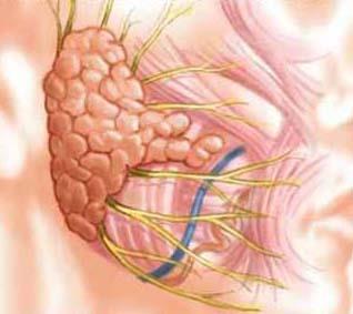 Tükürük Fizyolojisi Parotis salgısı esas olarak; Na, K ve Ca elektrolitlerini, amilazı, IgA yı, albumini, lizozimi, kallikreini ve tripsin inhibitörlerini içerir. IgG ve IgM az miktarda vardır.