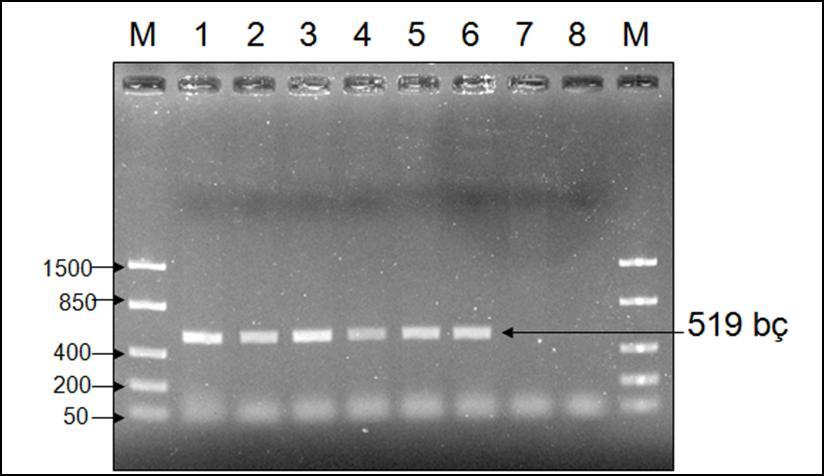 PCR Ürünlerinin Agarose Jel Elektroforez Bulguları Biyokimyasal testler sonucu olarak izole ve identifiye edilen 5 adet izolatın PCR ürünlerinin %1 agaroz jelde analizi sonucu 519 bç rpon gen