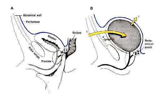 Vesica urinaria Şekli, boyutu, pozisyonu, komşulukları, geçici olarak içerdiği idrarın miktarı ve