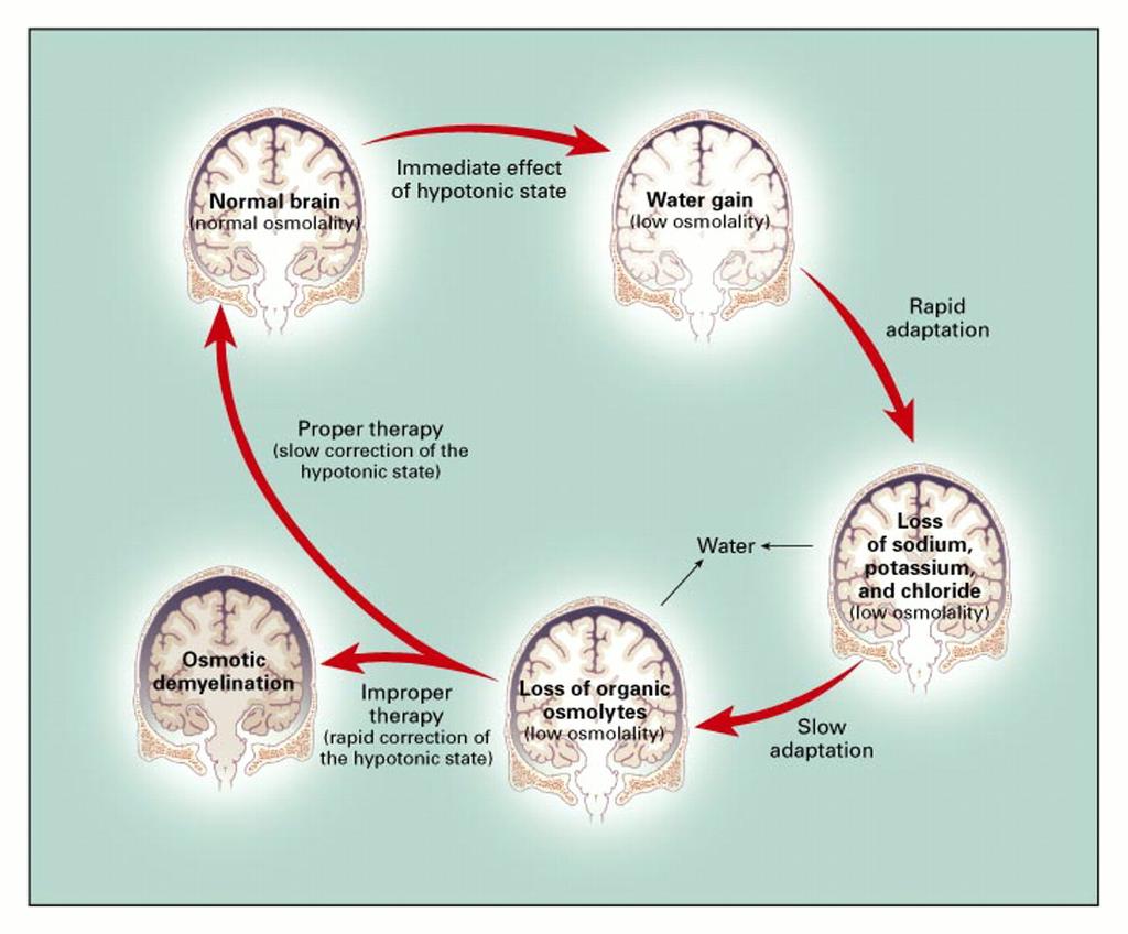 Effects of Hyponatremia on the Brain and Adaptive