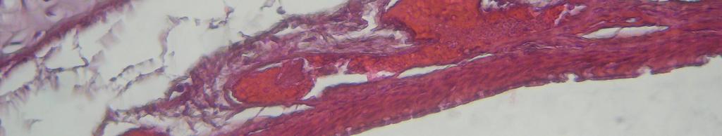 Nazal epitel hücrelerinde silyum