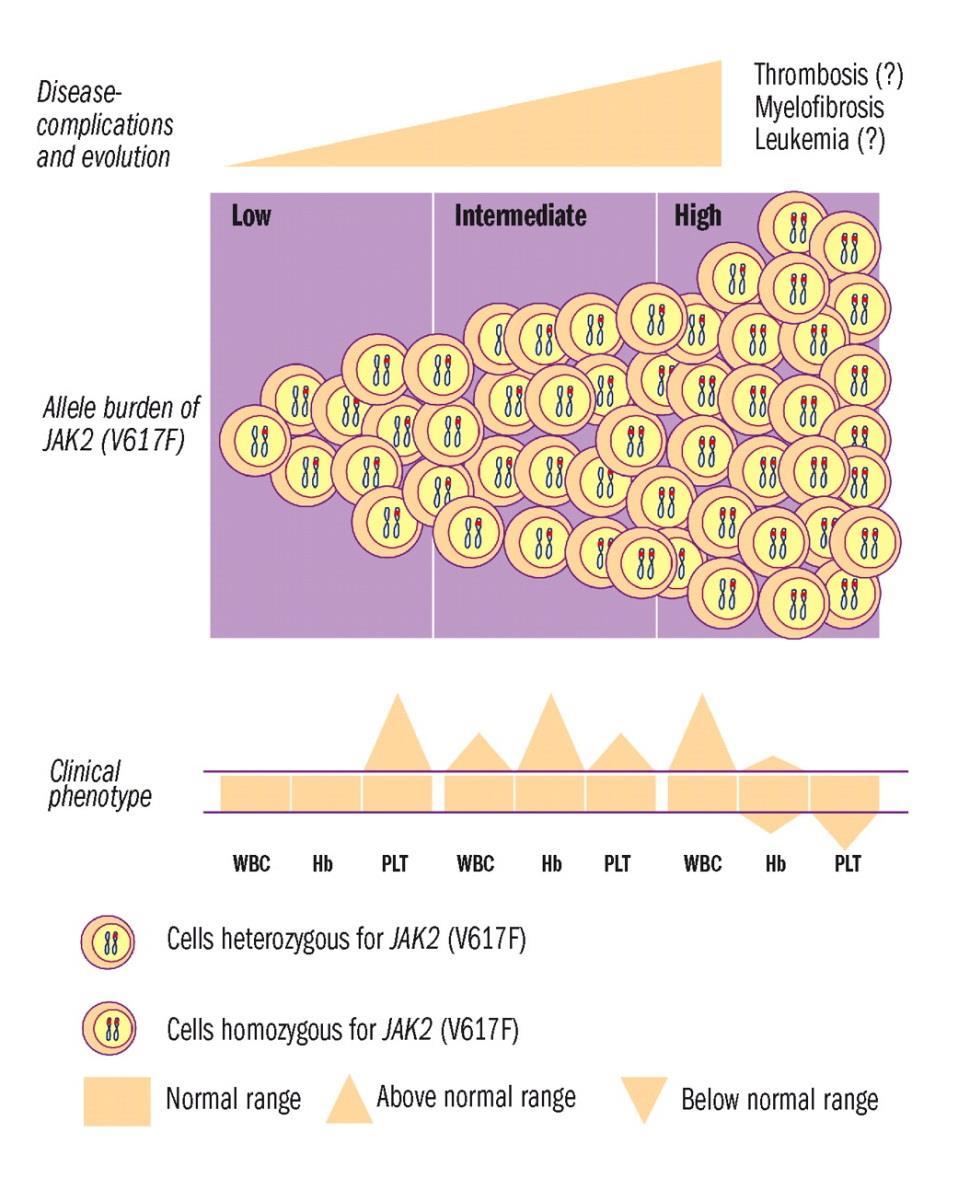 JAK2 (V617F) allele yükü klinik fenotiple ilişkisi ve hastalık