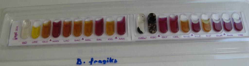 firma tarafından hazırlanan API 20 A kitapçığındaki değerlendirme tablosuna göre yapıldı. İzole edilen B.fragilis ve Clostridium spp.