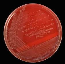 Actinomyces