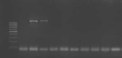 46 3.2.7. PCR Bulguları Süt, rektal svap ve altlık örneklerinden izole ve identifiye edilen E.