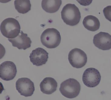 asetat Asidik sitrat agar Yüksek basınçlı sıvı kromatografisi (HPLC) Kapiller