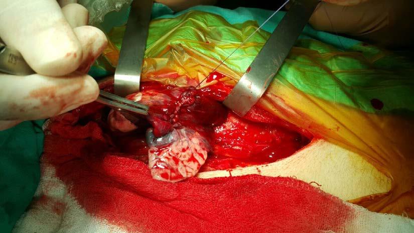 Note the hemorrhage through the laceration site. Figure 4.