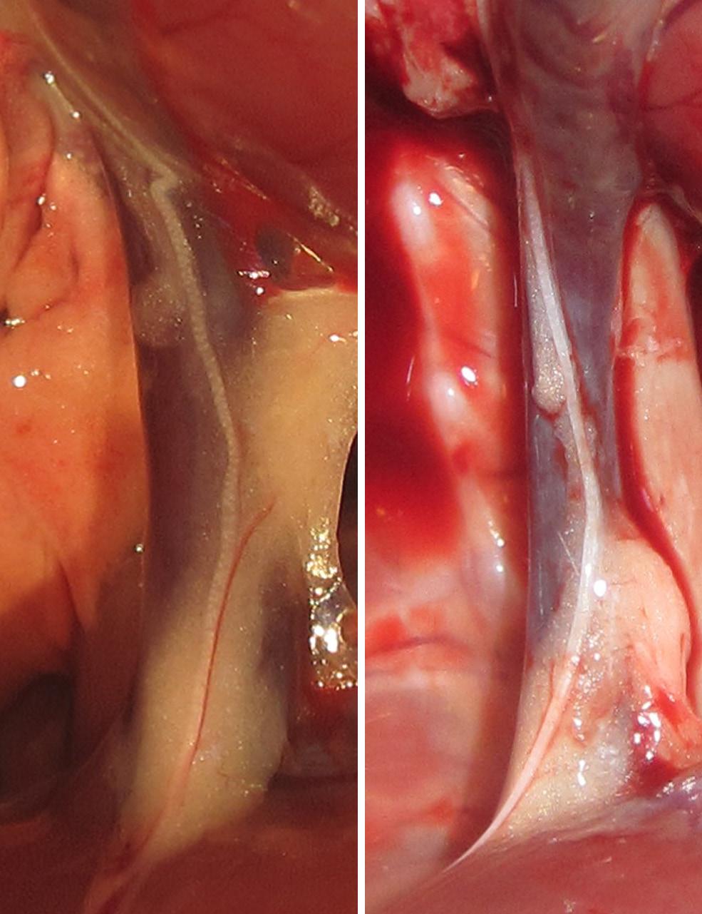 Aort daha sonra toraksın içinde aşağıya inmeye başlar, bu seyri sırasında columna vertebralis in solunda kalır. Abdominal boşluğa diafragma daki hiatus aorticus u geçerek girer.