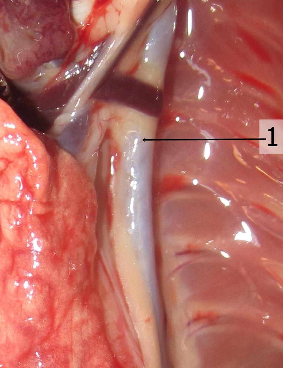 interkostal arterleri verir.