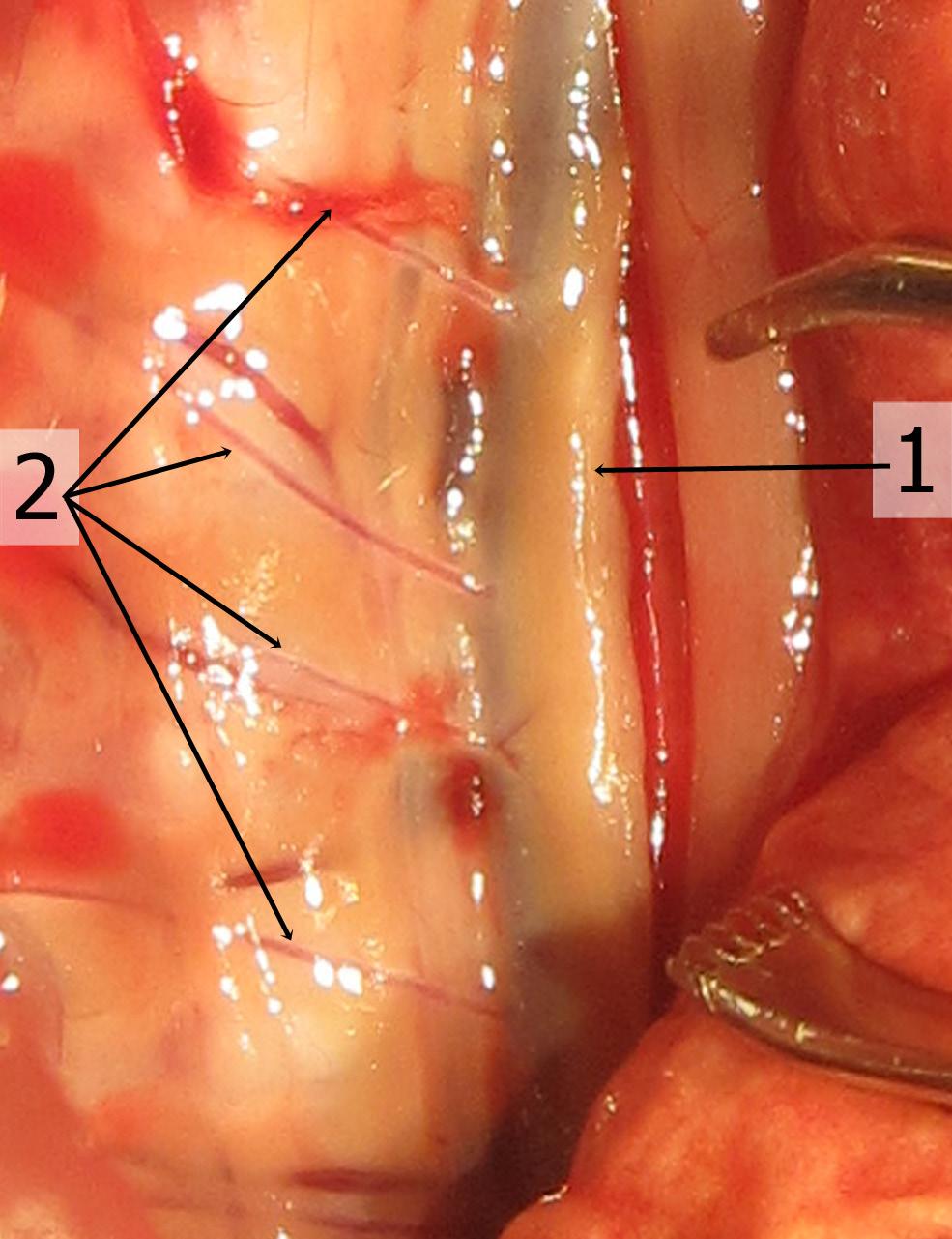 İnen aortanın torakal bölümü; posterior interkostal arterler (Şekil 63), subkostal arterler, bronşiyal arterler, özofageal arterler ve perikardiyal arterleri verir.