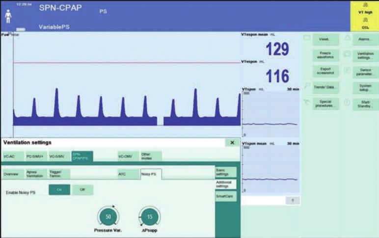 SPN-CPAP/PS ekranı D-52617-2012