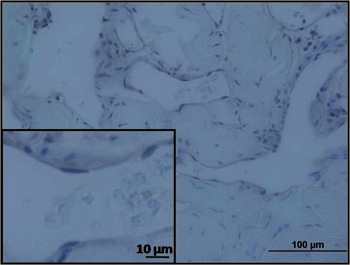 Ancak 72 saatlik LDL grubunda endotel hücrelerinin hepsinde e- nos tutulumu gözlendi.