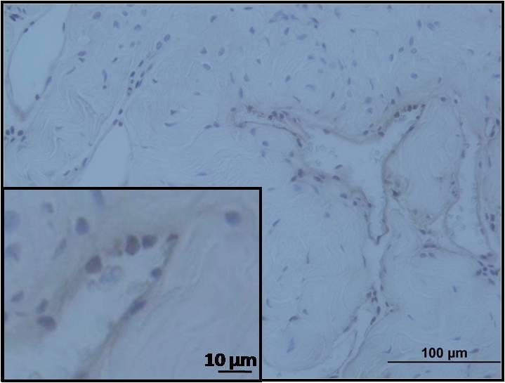 Resim 21: nldl enjeksiyonundan 2