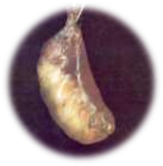 12. Tulumsu Yavru Çürüklüğü (Torba hastalığı, Sacbrood disease) Larva dönemi hastalığı olan tulumsu yavru çürüklüğü hastalığı, daha çok sırlanmış petek gözlerindeki larvalarda renk değişikliği, içi