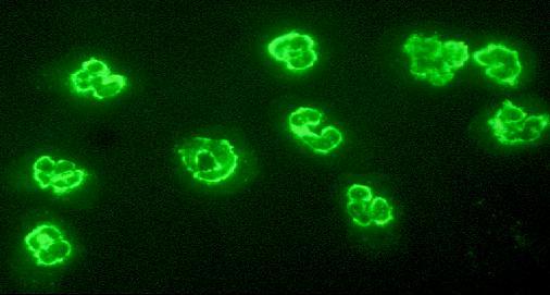 p-anca formalin dirençli granulocytes (EtOH) granulocytes