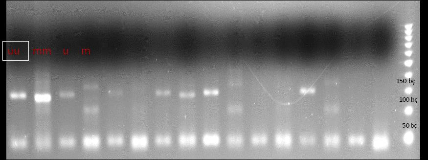 51 primer ve metile olmayan DNA ile konulan PCR ürünü UU ile, metile primer ve metile DNA ile konulan PCR ürünü MM ile temsil edilmiştir.