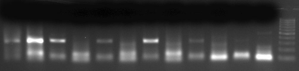 58 Şekil 3.9. BCL-2 geninin MSPCR sonucu elde edilen ürünlerinin %2 lik jelde görüntülenmesi MSPCR sonucunda, BCL-2 geni promotorunun HL-60 hücrelerinde metile olmadığı belirlenmiştir.