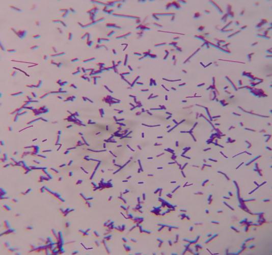 54 Resim 4.4 L. acidophilus BAZ36 nın otoagregasyonun ışık mikroskobu görüntüsü 4.8.2. Koagregasyon Lactobacillus suşları ile E.