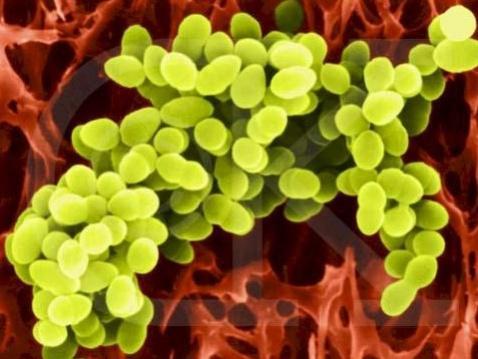 Genel özellikler Staphylococcus cinsine ait 45 tür vardır İnsanlardaki hastalıklarla en çok