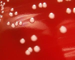 Morfolojik özellikler Birçok bakteriyolojik besiyerinde rahatlıkla ürerler En hızlı 37 o C de ürerler, ancak pigmentleri