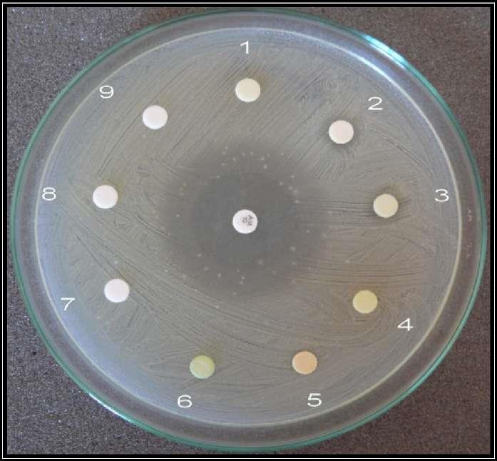 Çalışmamızda kullanılan Taraxacum farinosum ve Taraxacum mirabile bitkilerine ait çeşitli ekstraktların disk difüzyon yönteminde, test mikroorganizmalarına karşı antibakteriyal etkileri Tablo 3.