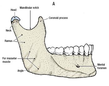 OS MANDİBULA Alt çene kemiği olarak da bilinen mandibula; Temporal kemiğe tutunan ve çene eklemini meydana Kemiğin alt ve önde yer alan